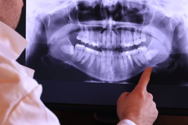 Best Emergency Denture Repair in Weber City, VA