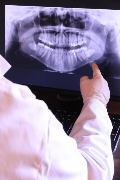 Best Emergency Tooth Extraction in Weber City, VA